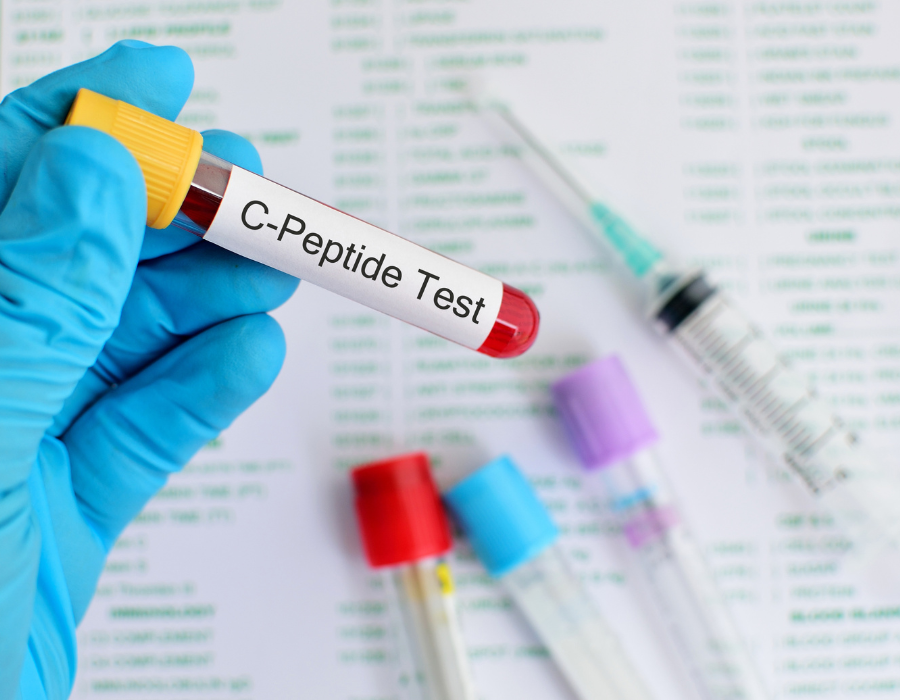 A peptide test